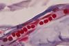 A microscopy photo showing a translucent blood vessel stretching across the image. It is filled with bright red blood cells that squeeze through the narrow tube in a single file