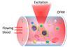 blood_laser